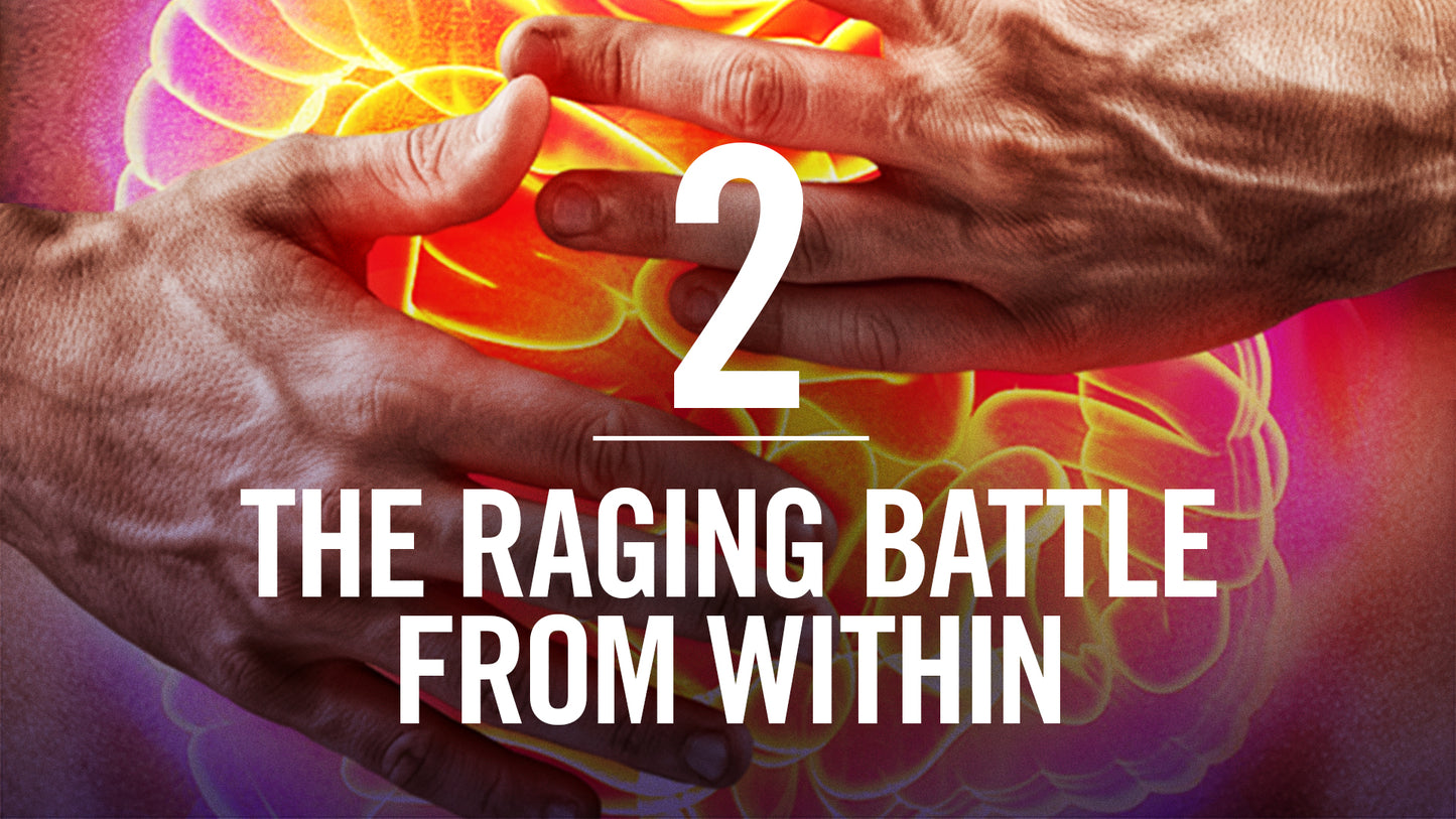 Interconnected Supported